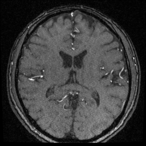 Click on the Serie image to view the images of VILLANUEVA, WILLIAM A.